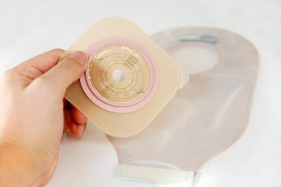 Entretien des stomies